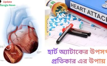 হার্ট অ্যাটাকের উপসর্গ ও প্রতিকার এর উপায়